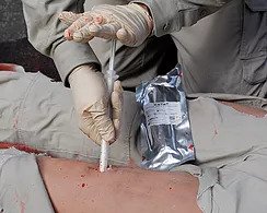 FDA clears XSTAT for the treatment of severe bleeding from gunshot and stab wounds to the arms or legs